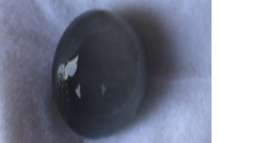 Cat Eye